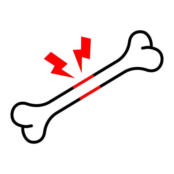 костна плътност - 31457 възможности