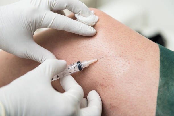 склеротерапия - 89468 вида