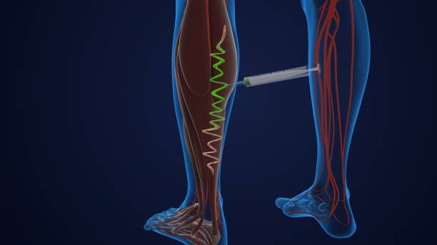 склеротерапия - 87016 бестселъри